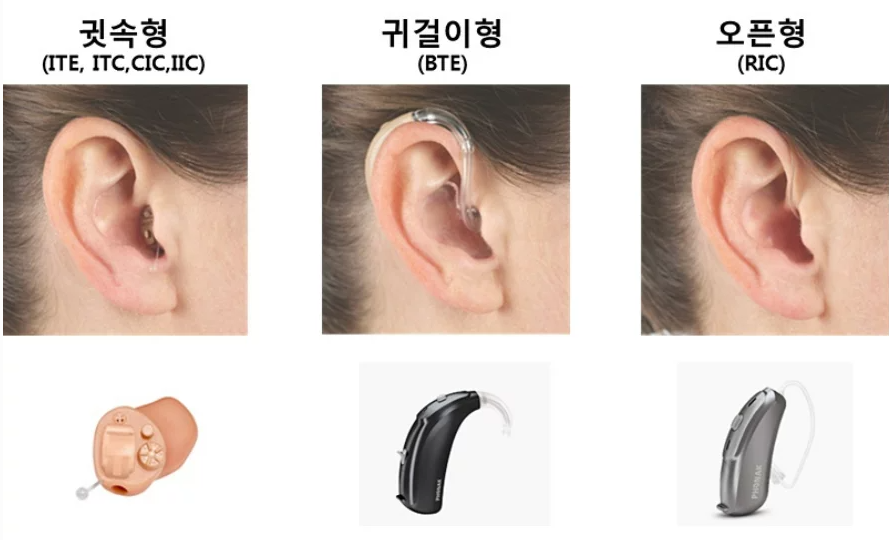 보청기 종류별 차이점 비교 이미지 - 귀걸이형, 귓속형, 삽입형 등 보장구별 특성